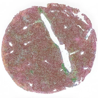 Cell population map of liver tissue from a young mouse, showing a rounded section divided by a large white channel