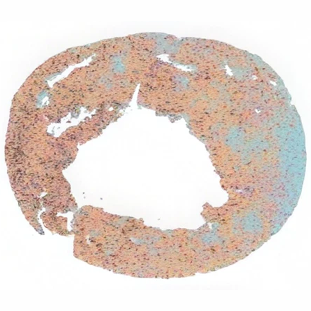 Cell population map of D and Q-treated liver tissue from an aged mouse, showing peach and pale blue regions around an open center