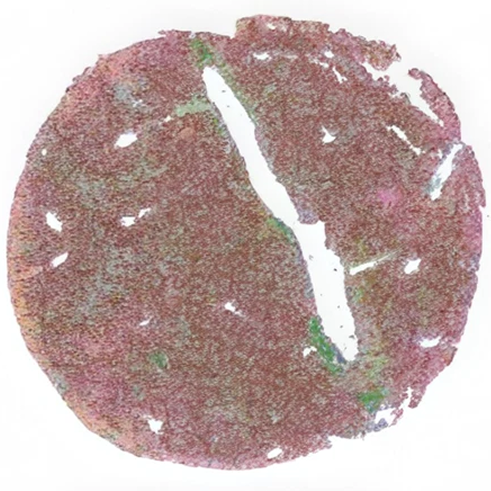 Cell population map of liver tissue from a young mouse, showing a rounded section divided by a large white channel