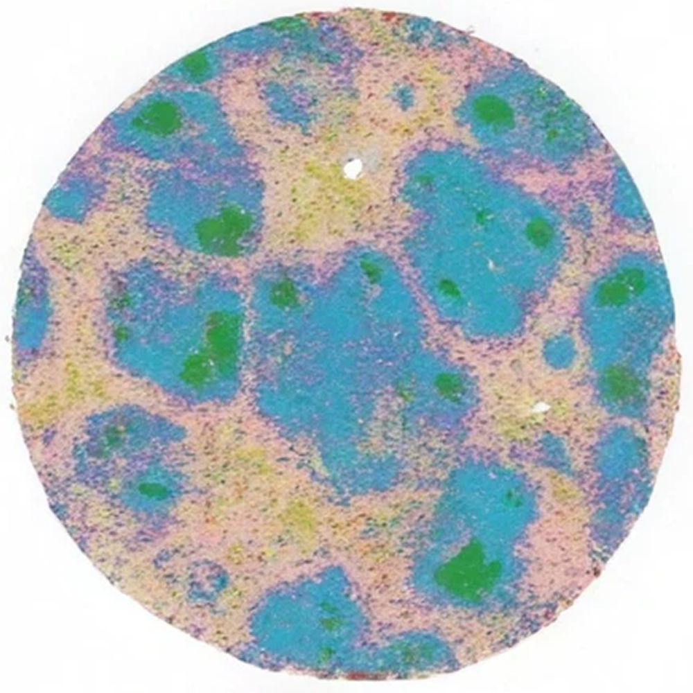 Cell population map of D and Q-treated spleen tissue from an aged mouse, showing blue clusters with green centers among pale pink regions
