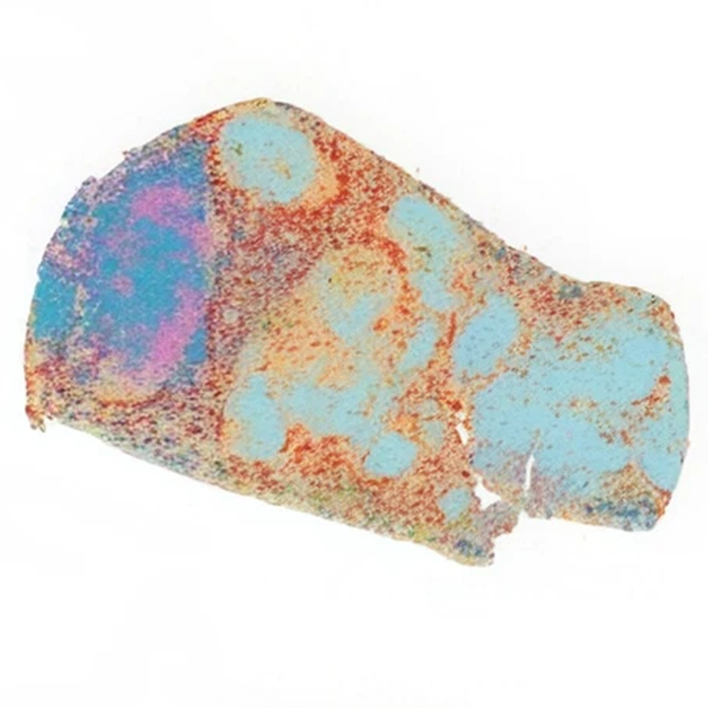 Cell population map of spleen tissue from a young mouse, showing light blue clusters and a dark blue and pink region