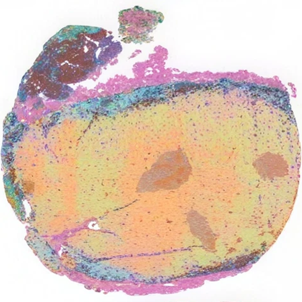 Cell population map of D and Q-treated thymus tissue from an aged mouse, showing a broad yellow and peach center bordered by turquoise and pink