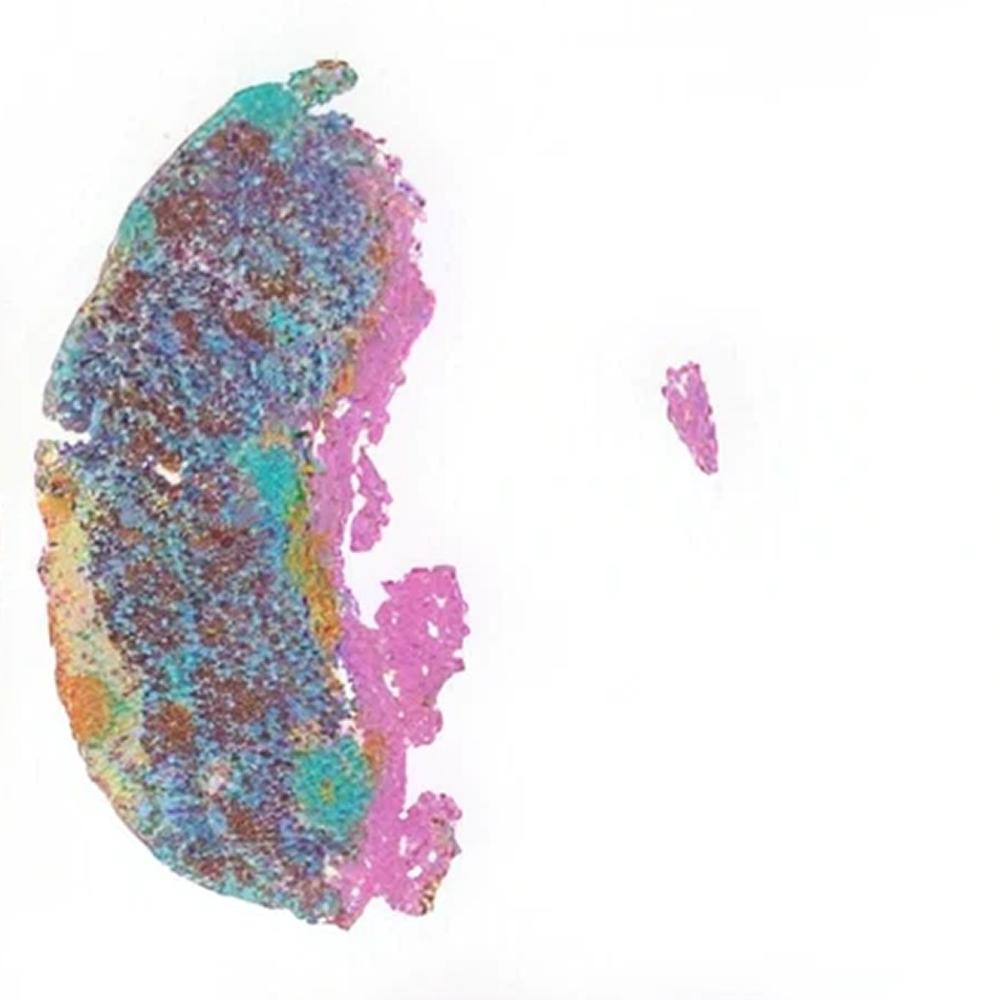 Cell population map of thymus tissue from an aged mouse, showing a narrow curved section with turquoise, dark blue, brown, and pink regions