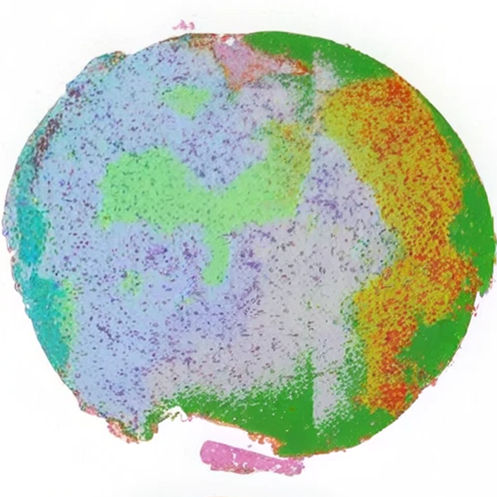 Cell population map of thymus tissue from a young mouse, showing broad pale blue, green, yellow, and orange regions
